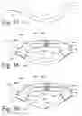Fig. 16 - Implanted Extracardiac Device for Circulatory Assistance