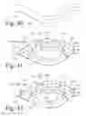 Fig. 17 - Implanted Extracardiac Device for Circulatory Assistance