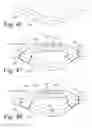 Fig. 19 - Implanted Extracardiac Device for Circulatory Assistance