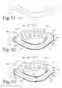 Fig. 24 - Implanted Extracardiac Device for Circulatory Assistance