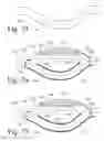 Fig. 28 - Implanted Extracardiac Device for Circulatory Assistance