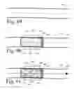 Fig. 33 - Implanted Extracardiac Device for Circulatory Assistance