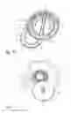 Fig. 09 - Hand-held drug injection device and dose setting limiter mechanism therefor