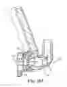 Fig. 17 - Nasal continuous positive airway pressure device