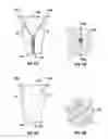 Fig. 18 - Nasal continuous positive airway pressure device