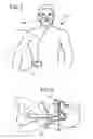 Fig. 03 - Methods, systems and devices for non-invasive open ventilation with gas delivery nozzles with an outer tube