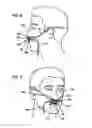 Fig. 06 - Methods, systems and devices for non-invasive open ventilation with gas delivery nozzles with an outer tube