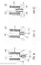 Fig. 07 - Methods, systems and devices for non-invasive open ventilation with gas delivery nozzles with an outer tube