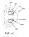 Fig. 12 - Methods, systems and devices for non-invasive open ventilation with gas delivery nozzles with an outer tube