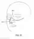 Fig. 14 - Methods, systems and devices for non-invasive open ventilation with gas delivery nozzles with an outer tube