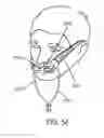 Fig. 37 - Methods, systems and devices for non-invasive open ventilation with gas delivery nozzles with an outer tube
