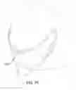 Fig. 55 - Methods, systems and devices for non-invasive open ventilation with gas delivery nozzles with an outer tube
