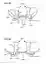 Fig. 62 - Methods, systems and devices for non-invasive open ventilation with gas delivery nozzles with an outer tube