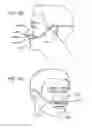 Fig. 67 - Methods, systems and devices for non-invasive open ventilation with gas delivery nozzles with an outer tube