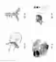 Fig. 02 - Systems for automatically removing fluid from multiple regions of a respiratory tract