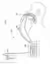 Fig. 03 - Systems for automatically removing fluid from multiple regions of a respiratory tract