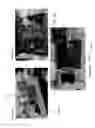 Fig. 17 - Systems for automatically removing fluid from multiple regions of a respiratory tract