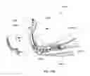 Fig. 20 - Systems for automatically removing fluid from multiple regions of a respiratory tract