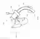 Fig. 34 - Systems for automatically removing fluid from multiple regions of a respiratory tract