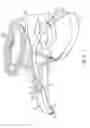 Fig. 04 - Fiberoptic Bronchoscopy Intubation Device and Method of Using the Same