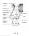Fig. 13 - Neck strap, crown strap assembly and headgear for a breathing mask