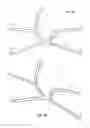 Fig. 23 - Neck strap, crown strap assembly and headgear for a breathing mask