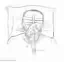 Fig. 01 - Storage device for a ventilation mask