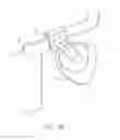 Fig. 13 - Storage device for a ventilation mask