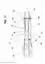 Fig. 11 - Apparatus and method for maintaining airway patency and pressure support ventilation