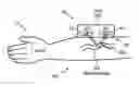 Fig. 01 - System and method for enhancing sleep slow wave activity based on cardiac activity