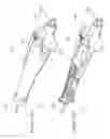 Fig. 02 - Steering control mechanism for catheter