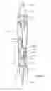 Fig. 03 - Steering control mechanism for catheter