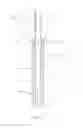 Fig. 02 - Inverted balloon neck on catheter