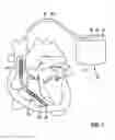 Fig. 02 - Implantable electrical line