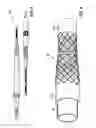 Fig. 07 - Implantable electrical line