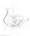 Fig. 02 - Implantable device with electrical filter