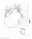 Fig. 02 - Apparatus for treating pelvic floor disorders and related methods of use