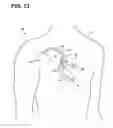 Fig. 16 - Systems, methods, and interfaces for configuring cardiac therapy