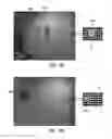 Fig. 03 - Pattern detection and location indication for a visual prosthesis