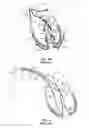 Fig. 05 - Cardiac resynchronization therapy utilizing P-wave sensing and dynamic anticipative left ventricular pacing