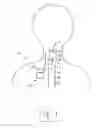 Fig. 05 - Systems and methods for treating post-traumatic stress disorder