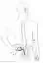 Fig. 01 - External pulse generator device and associated methods for trial nerve stimulation