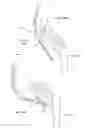 Fig. 25 - Electromyographic lead positioning and stimulation titration in a nerve stimulation system for treatment of overactive bladder