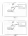 Fig. 35 - Electromyographic lead positioning and stimulation titration in a nerve stimulation system for treatment of overactive bladder