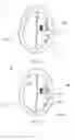 Fig. 14 - System for planning and/or providing a therapy for neural applications