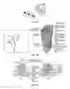 Fig. 17 - Systems and methods for neurostimulation electrode configurations based on neural localization