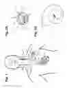 Fig. 02 - Vagus nerve stimulation and subcutaneous defibrillation system