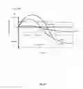 Fig. 06 - Vagus nerve stimulation and subcutaneous defibrillation system