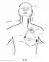 Fig. 09 - Vagus nerve stimulation and subcutaneous defibrillation system
