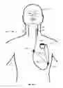 Fig. 11 - Vagus nerve stimulation and subcutaneous defibrillation system